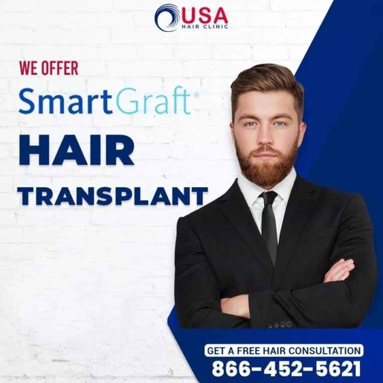 Weighing Hair Replacement vs Transplant for Your Perfect Look